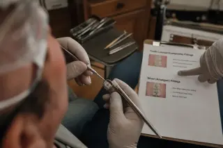 Dentist's gloved hands preparing a composite filling on an adult patient's molar, with a dental material chart nearby in a warmly lit, authentic dental office.